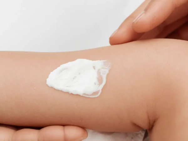 العناية بجلد الطفل الحساس — دليل شامل للأمهات